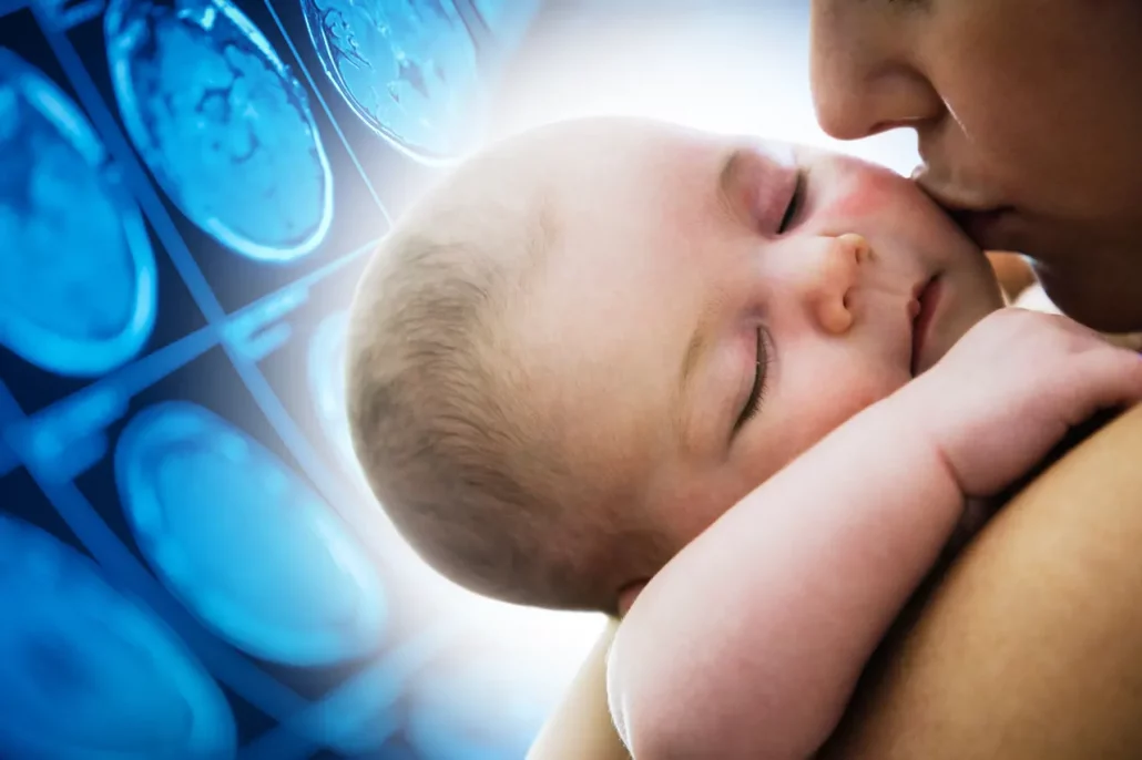 Infant Brain Damage Results in $10 Million Dollar Birth Injury Settlement